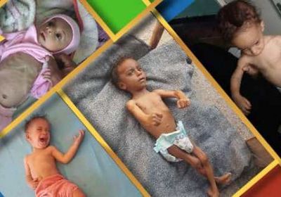 صحيفة بريطانية: "فيسبوك" يفرض رقابة على صور الأطفال الجوعى في اليمن