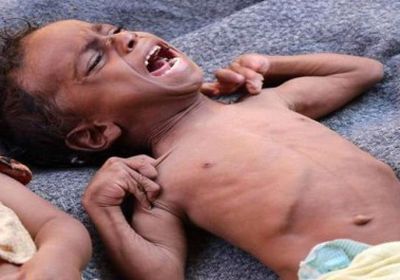 نشطاء تويتر يطلقون هاشتاج "المجاعة بمسيمير لحج"