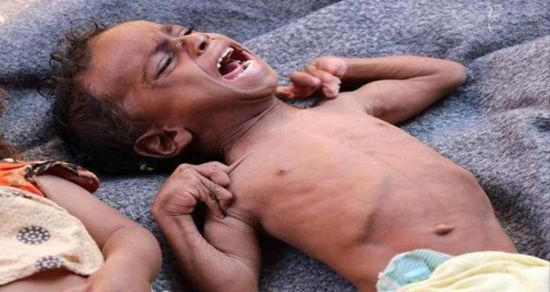 نشطاء تويتر يطلقون هاشتاج "المجاعة بمسيمير لحج"