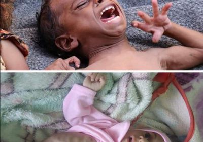 "المجاعة تجتاح المسيمر".. نشطاء يتداولون صورا لأطفال المدينة