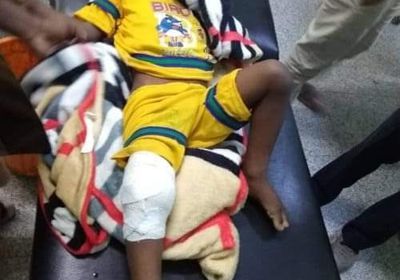  رصاص راجع يتسبب في دخول طفل العناية المركزة بأبين (شاهد)