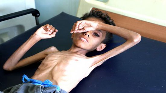 شبح المجاعة يهدد اليمن.. المليشيات تنهب والحكومة محلك سر