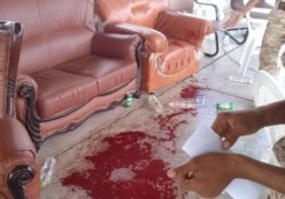 استهداف قاعدة العند العسكرية من قبل المليشيات الحوثي في صور