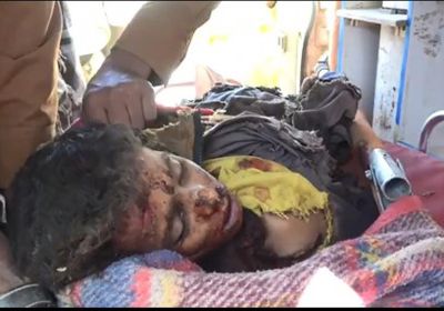 قتلى وجرحى بينهم نساء وأطفال بقصف حوثي على مناطق في حجة والجوف