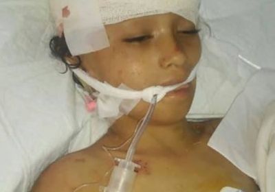 رصاص راجع يودي بحياة طفلة في تعز (اسم وتفاصيل)