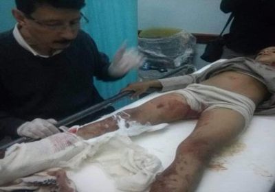 إصابة مدنيين بمقذوف حوثي في مأرب (أسماء)
