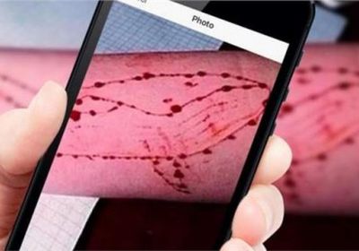 حالة انتحار جديدة لطفل بإب بسبب لعبة الحوت الأزرق.. تفاصيل