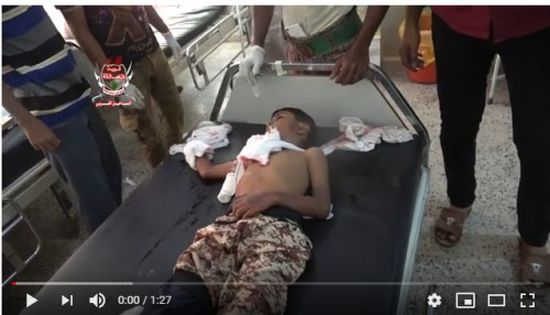 استشهاد طفل وإصابة ابنة عمه في قصف حوثي بحيس (فيديو)