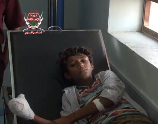بتر أصابع يد طفل جراء انفجار لغم حوثي في حيس (فيديو)