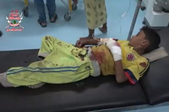 مجزرة حوثية في الحديدة.. استشهاد وإصابة مواطنين في حيس (فيديو)