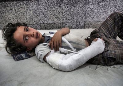 برنامج الأغذية العالمي: الجوع في اليمن يهدد جيلا بأكمله