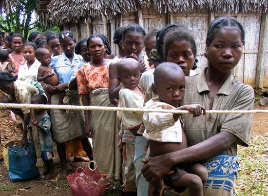 الحصبة تتسبب في مقتل نحو ألف طفل في مدغشقر منذ أكتوبر 