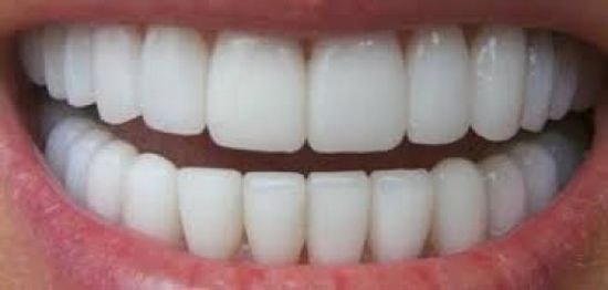 دراسة حديثة ..الأسنان تكشف حالتك الصحية والعقلية