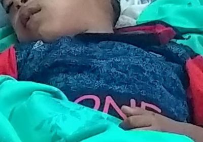 وفاة طفل وامرأة بسبب كلب مسعور بطور الباحة في لحج&nbsp;