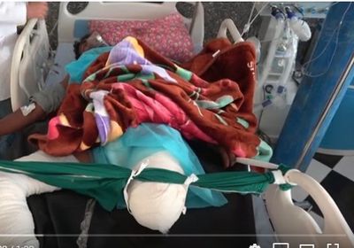 إصابة مواطن بانفجار لغم حوثي في أطراف الحديدة (فيديو)