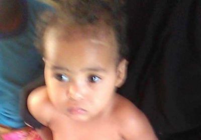 عائشة.. طفلة مهمشة تقع فريسة لضمور الدماغ.. وأسرتها تناشد المنظمات وأهل الخير إنقاذ حياتها