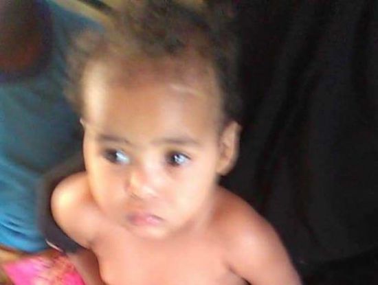 عائشة.. طفلة مهمشة تقع فريسة لضمور الدماغ.. وأسرتها تناشد المنظمات وأهل الخير إنقاذ حياتها