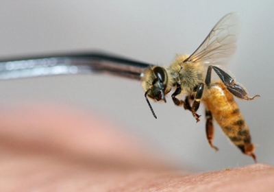 دراسة حديثة : لسعات النحل تعالج آلام أسفل الظهر المزمنة