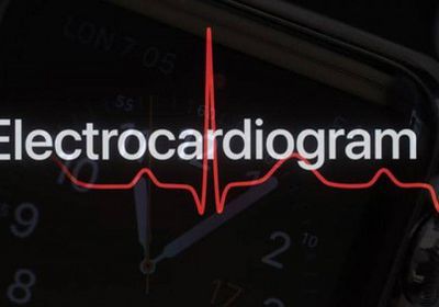 دراسة: ساعة أبل تقدر على رصد مشاكل القلب 