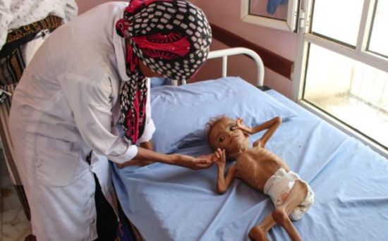بعد أزمة الوقود.. اقتصاديون: المجاعة تغزو صنعاء بعد فشل الحوثي في ابتزاز البنوك
