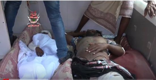 إصابات خطيرة في انفجار لغم حوثي في منزل مواطن بالحديدة (فيديو)