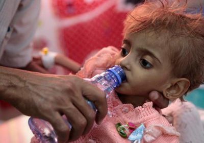 قصة مأساوية.. " الطفلة عفاف " التي حوّلتها الحرب الحوثية إلى " لحم على عظم " 
