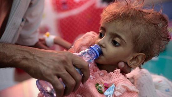 قصة مأساوية.. " الطفلة عفاف " التي حوّلتها الحرب الحوثية إلى " لحم على عظم " 