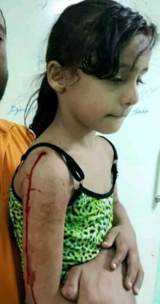 إصابة طفلة بطلق ناري راجع بحي ريمي في مديرية المنصورة