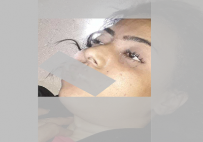 العثور على جثة فتاة مقتولة في بير فضل