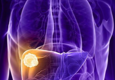 مؤتمر عالمي لأمراض الكبد: 257 مليون نسمة مصابين بفيرس بي