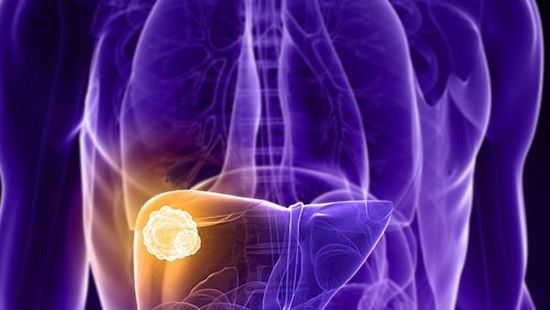 مؤتمر عالمي لأمراض الكبد: 257 مليون نسمة مصابين بفيرس بي