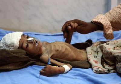 بعد تسجيل 209 حالة وفاة.. «الكوليرا» تفضح مليشيات الانقلاب في اليمن