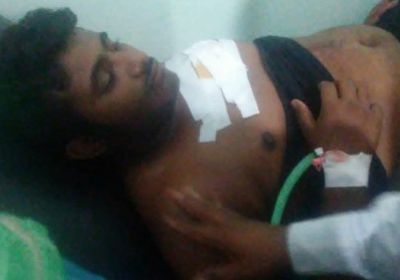 إصابة مواطن برصاص قناصة المليشيات أمام منزله في حيس بالحديدة 