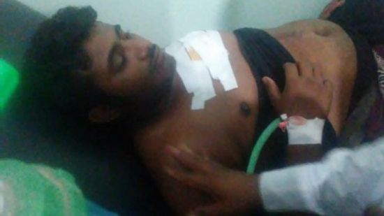 إصابة مواطن برصاص قناصة المليشيات أمام منزله في حيس بالحديدة 