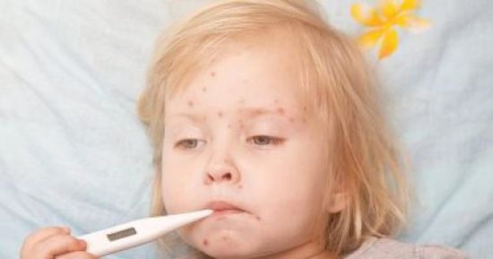  أمريكا: استمرار تفشي مرض الحصبة في ٢٢ ولاية منذ بداية العام