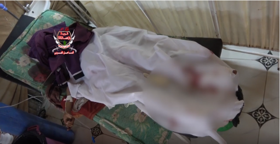 استشهاد رضيعة بقذيفة حوثية في الدريهمي بالحديدة (فيديو)