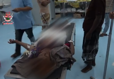 إصابة مواطنة في قصف حوثي لإحدى مناطق الحديدة
