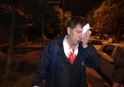 حلفاء أردوغان يعتدون على معارض تركي بمضارب البيسبول