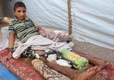 عبد الله..قصة مؤلمة لطفل يمني أعاقته ألغام المليشيات