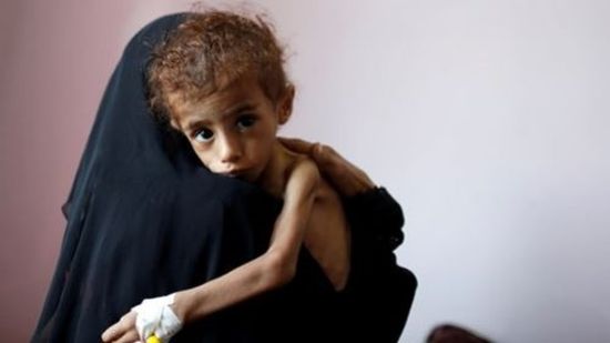 نُذر فاجعة إنسانية.. "الغذاء العالمي" يطالب بممرات آمنة في اليمن