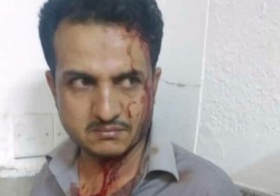 مشرف حوثي يعتدي على طبيب في مستشفى الثورة بصنعاء (تفاصيل) 