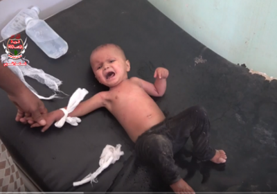 بينهم طفل..قذيفة حوثية تصيب أسرة في حيس بالحديدة (فيديو)