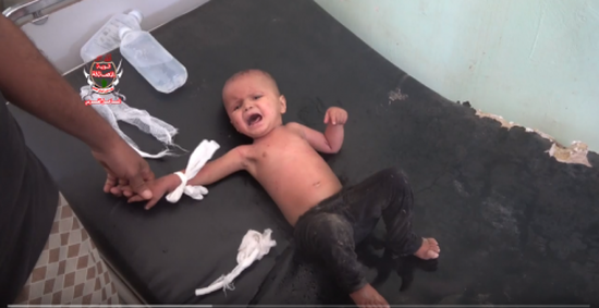 بينهم طفل..قذيفة حوثية تصيب أسرة في حيس بالحديدة (فيديو)