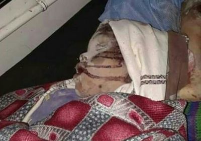 مصرع وإصابة عدة أطفال جراء قصف حوثي بالضالع