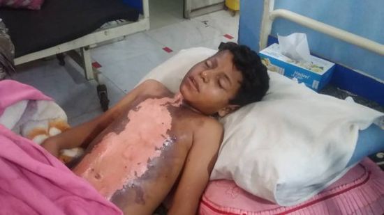 إصابة 3 أطفال بصاعقة رعدية بردفان 