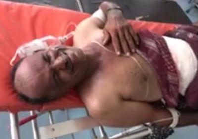 قناصة الحوثي تصيب مواطن مسن في حيس