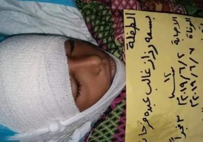 استشهاد الطفلة بسمة جراء إصابتها برصاص قناصة الحوثي في تعز