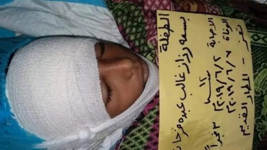 استشهاد الطفلة بسمة جراء إصابتها برصاص قناصة الحوثي في تعز