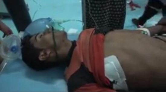 استشهاد وإصابة 4 شبان جراء انفجار لغم حوثي بالخوخة (صور)  &nbsp;