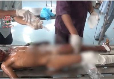 استشهاد طفل وإصابة شقيقه في انفجار مقذوف حوثي في الحيمة بالتحيتا (فيديو) 